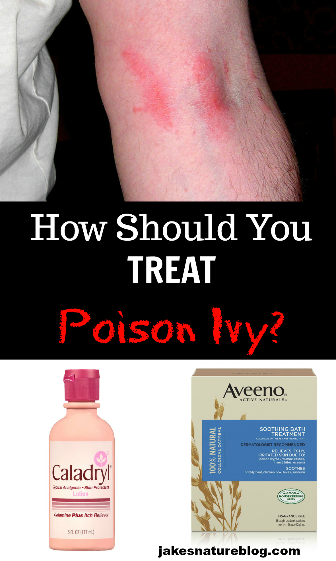 Best Way To Cure Poison Ivy Rash